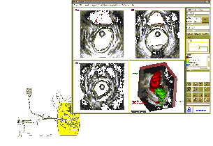 3D-Sonographie