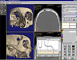 Radiologische Befundung am Monitor. Klick zur Vergrößerung des Bildes