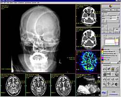 Radiologische Befundung am Monitor. Klick zur Vergrößerung des Bildes